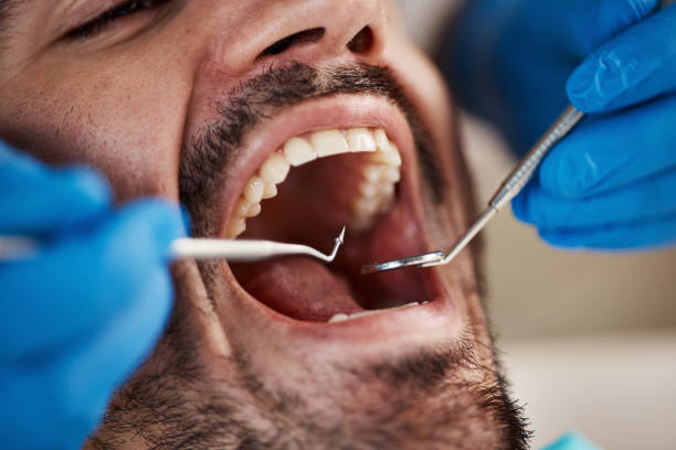 Best Emergency Gum Treatment in Konterra, MD
